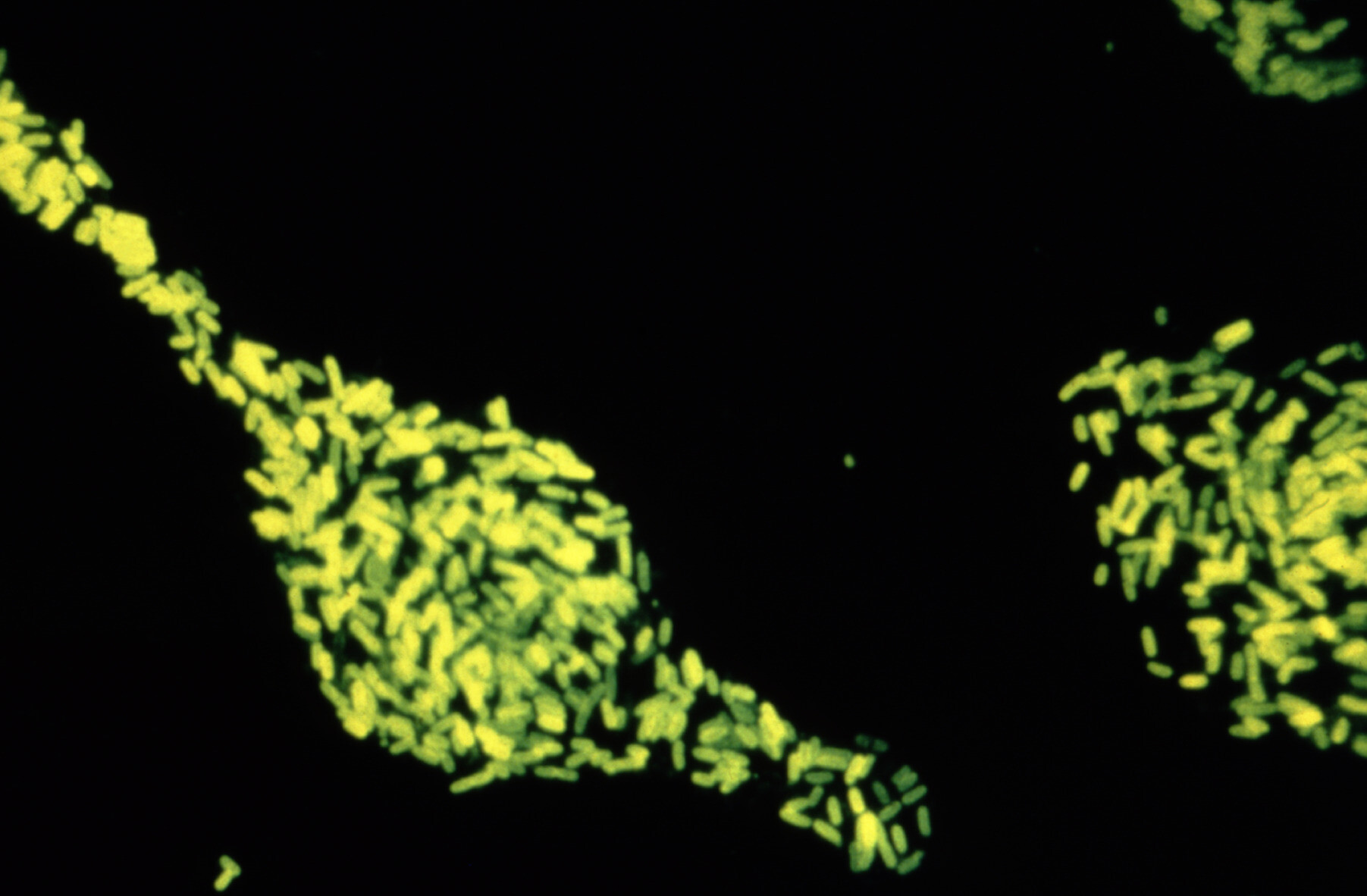 Bacterial Infections Of The Gastrointestinal Tract StoryMD