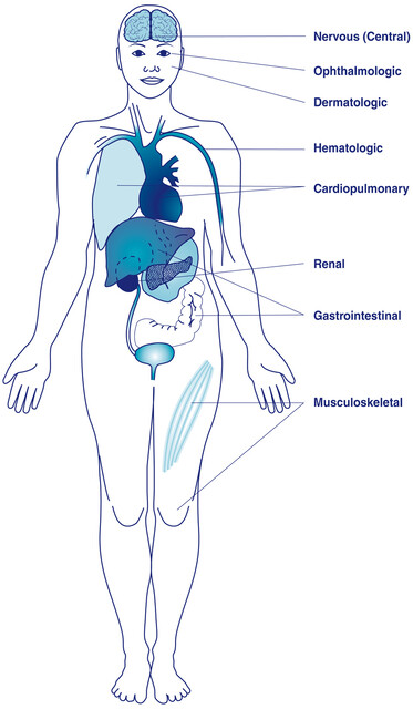 Lupus: An Attack From Within - StoryMD