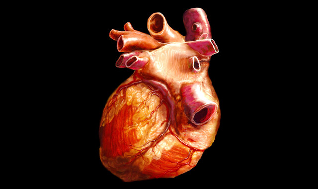 Homocysteine Test: Why Is It Done and What the Results Mean - StoryMD