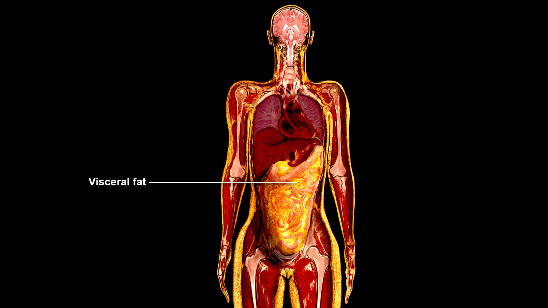 The link between abdominal fat and death: What is the shape of health? -  Harvard Health