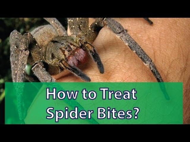 Symptoms of Venomous Spider Bites - StoryMD