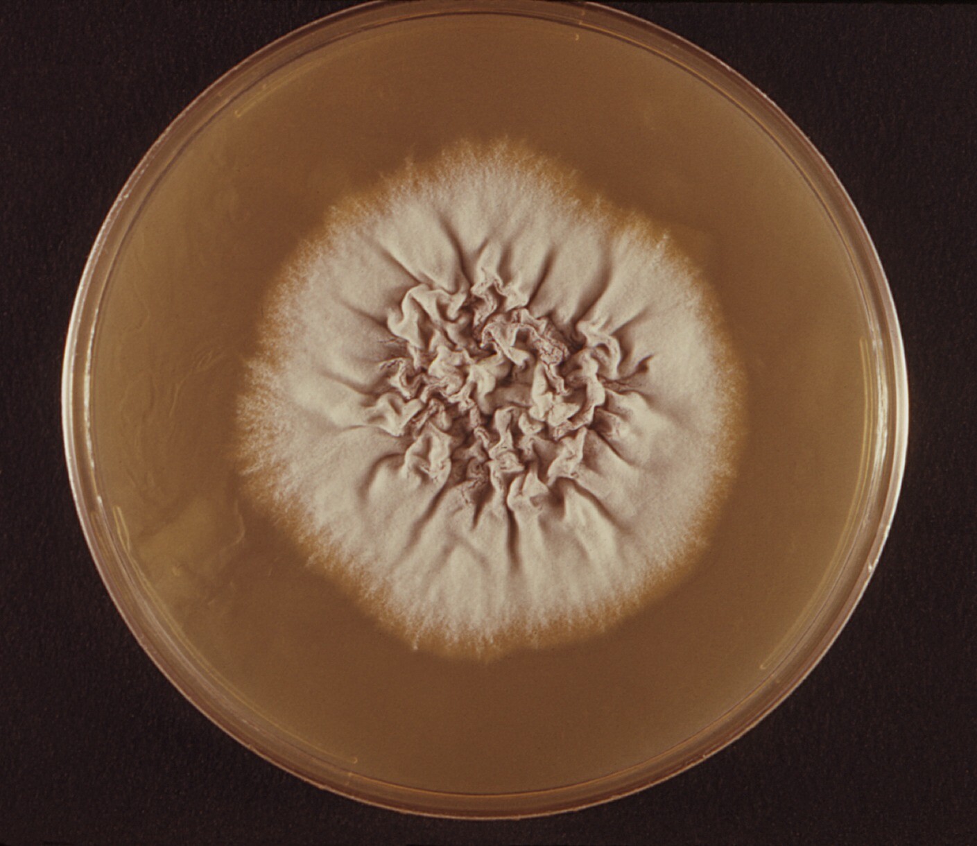 Среда кожи. Trichophyton verrucosum. Trichophyton gypseum. Trichophyton rubrum грибок ногтя.