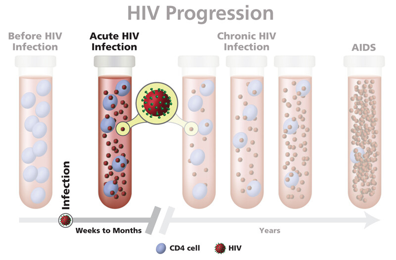 Acute Hiv Infection Timeline