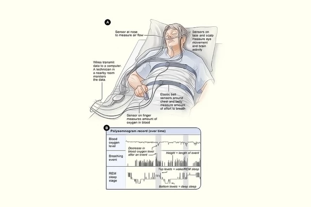 Assessment of Sleep Disorders - StoryMD