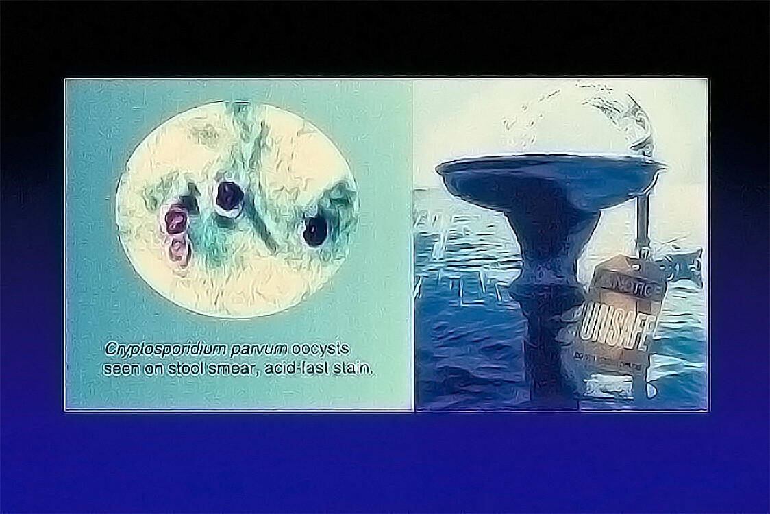 Cryptosporidium General Information - StoryMD
