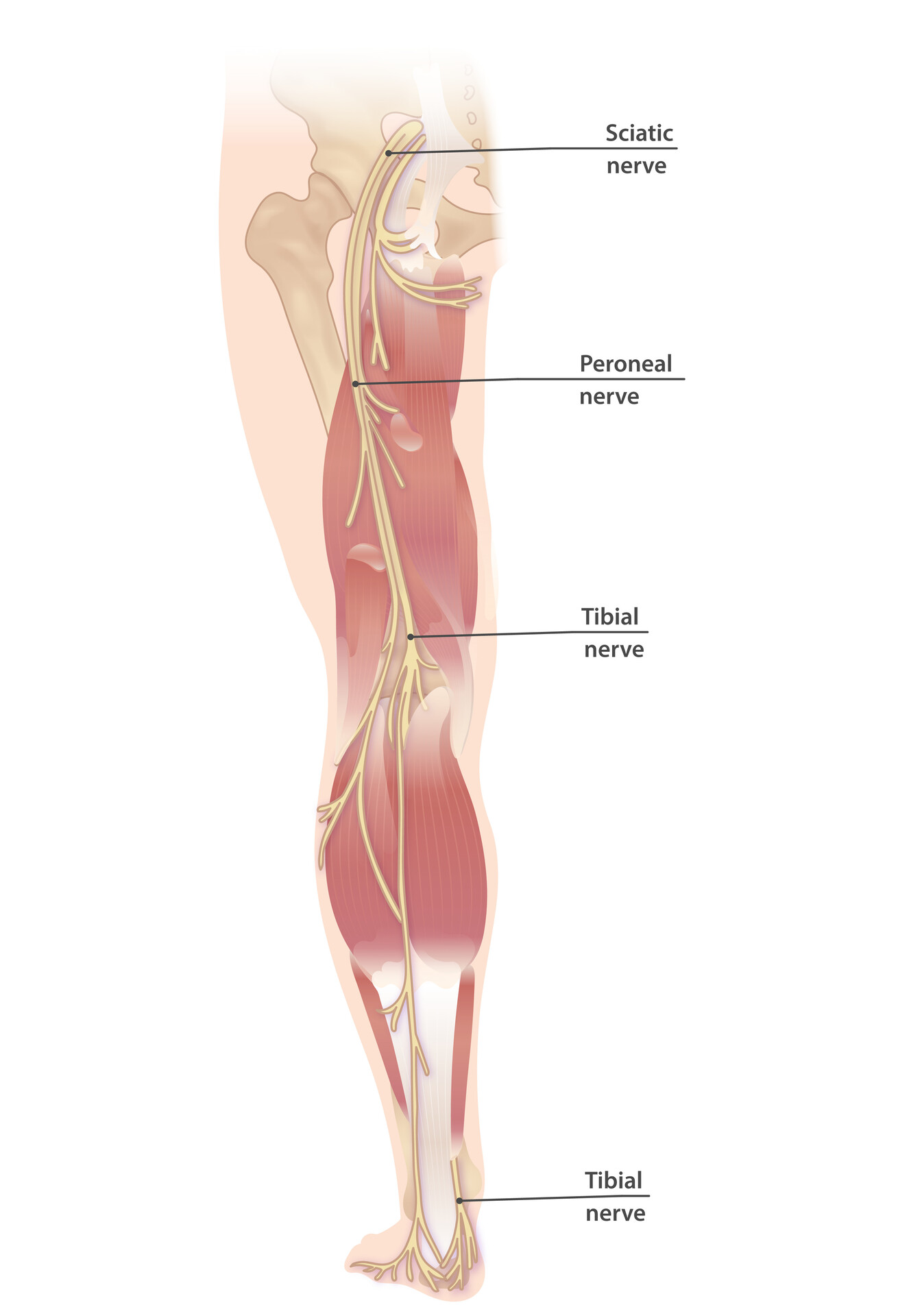 Sciatica - StoryMD