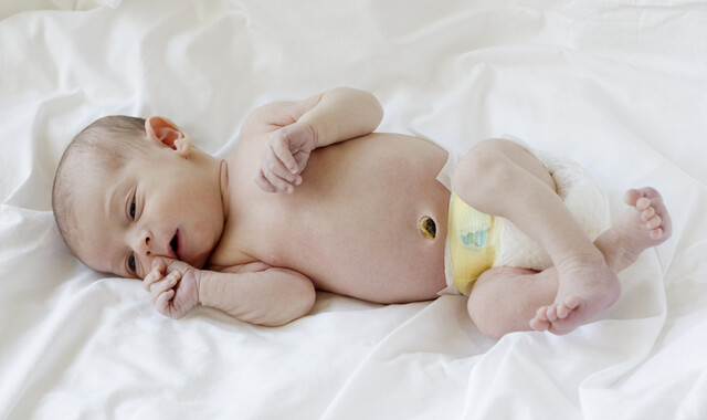 How to care for a baby's umbilical cord 