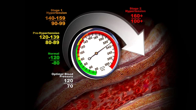 Blood Pressure Measurement - OSCE Guide, BP Reading