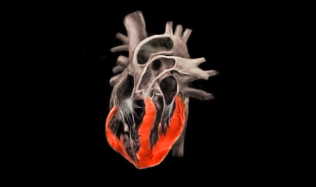 Understanding Heart Inflammation