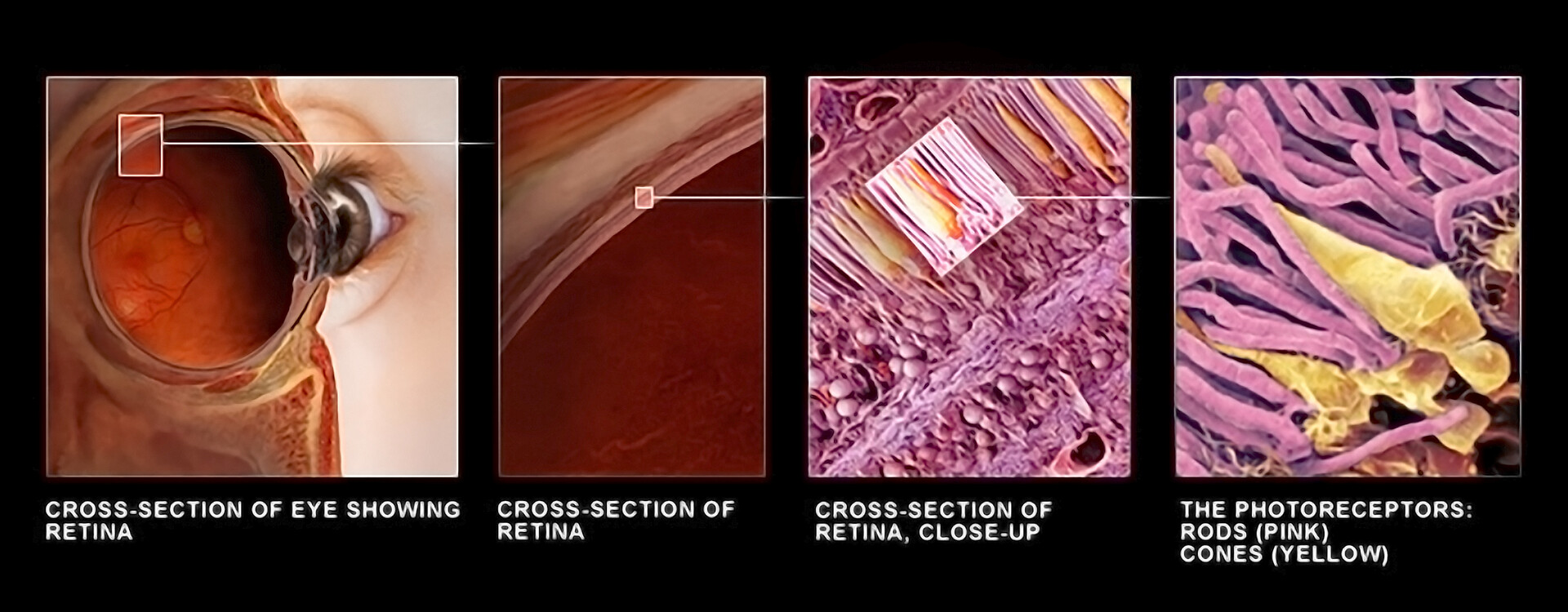 Eyeball In Section Structure Of The Retina Closeup Stock