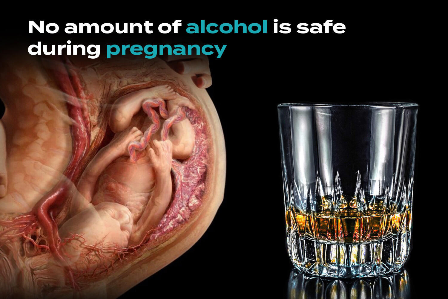 Alcohol During Pregnancy