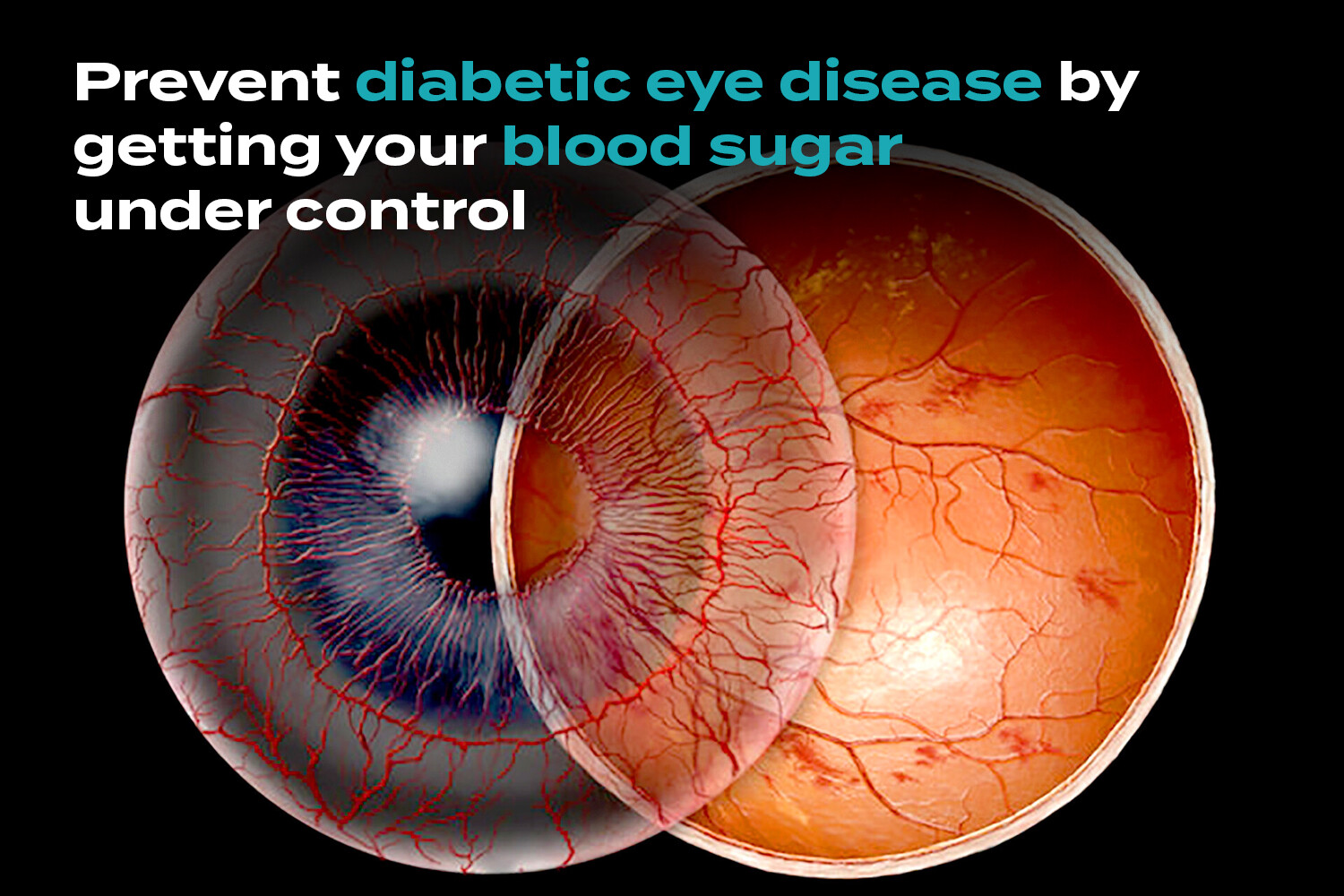 Can Too Much Sugar Cause Eye Problems