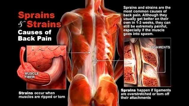 Muscle Pain: Causes and Treatment, Healthyhome