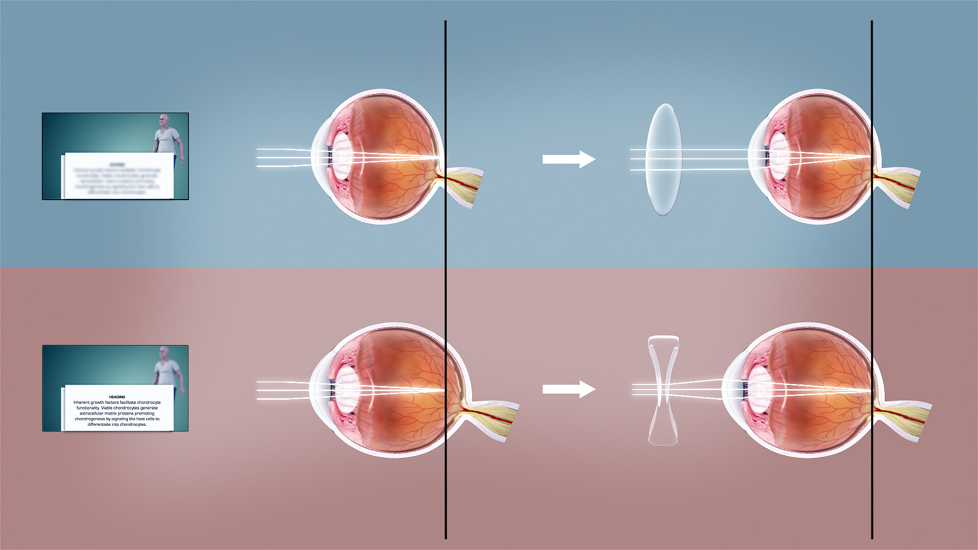 How Do Eyeglasses Work Storymd 7465