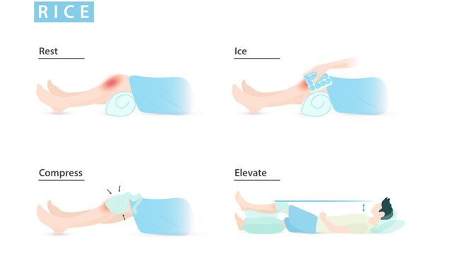 RICE Technique - Rest, Ice, Compression, and Elevation