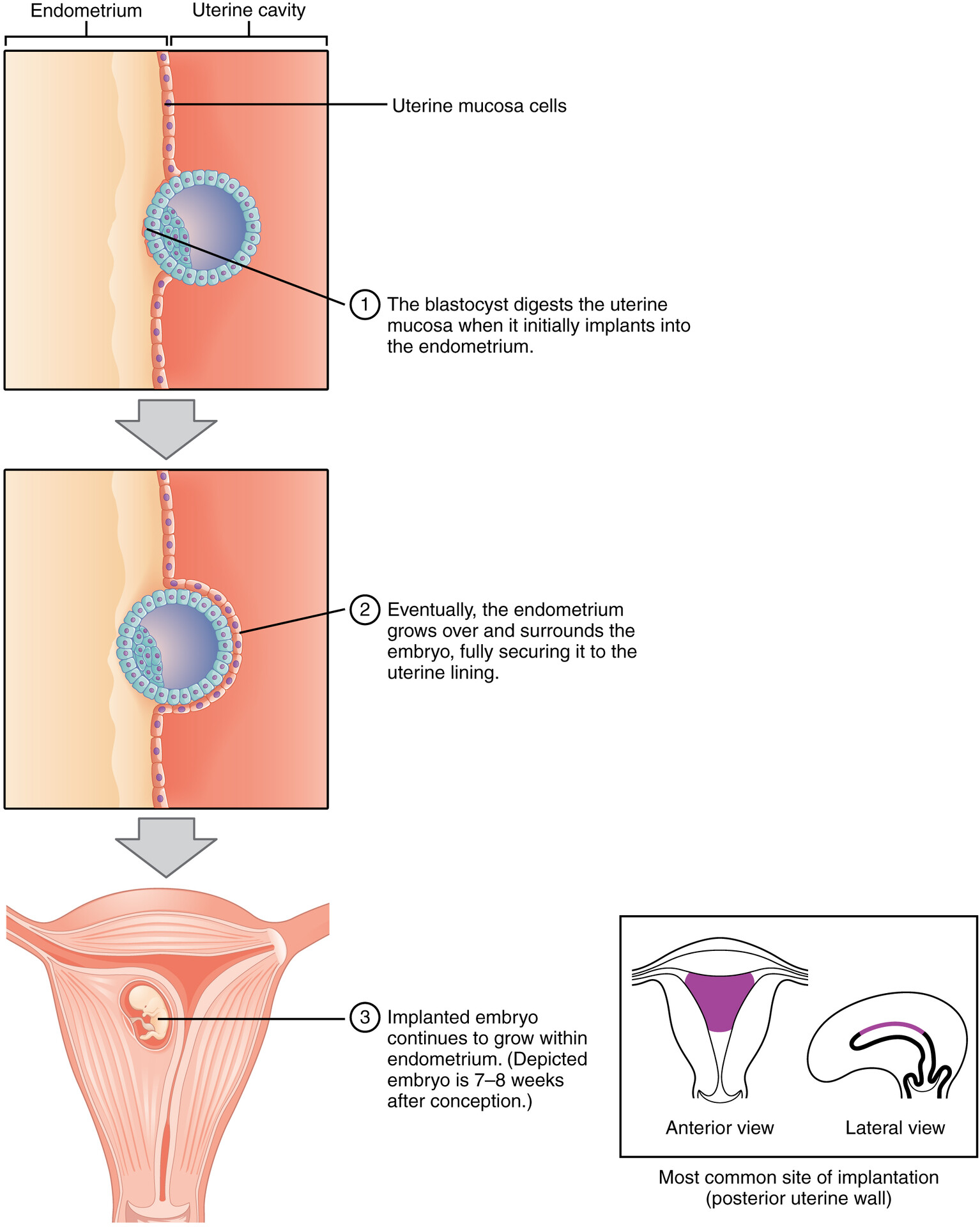 implantation diagram