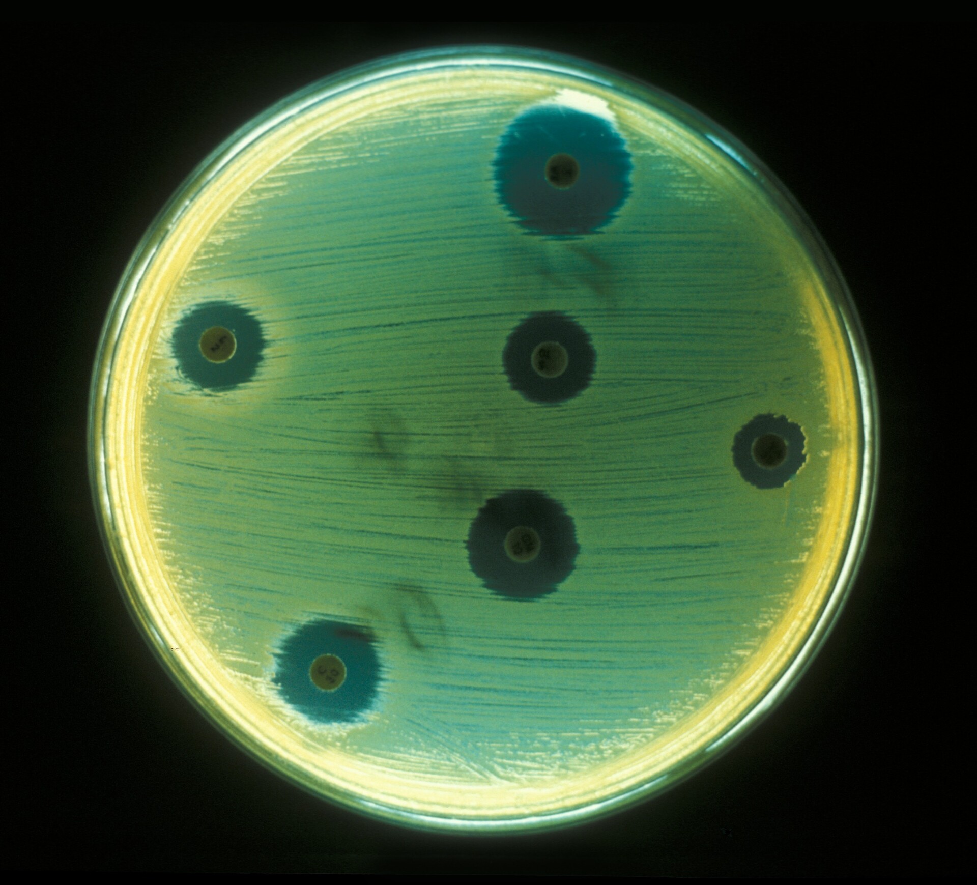 Staphylococcal Infections - StoryMD