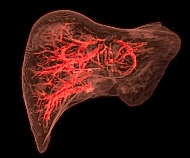 Liver और किडनी की सफाई के लिए डाइट में शामिल करें ये 7 फूड्स, नेचुरल तरीके से होगा शरीर डिटॉक्स 6 Keeping Your Liver Healthy When You Have Hepatitis - Storymd