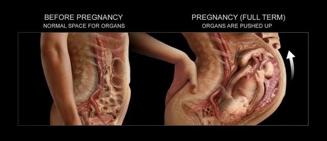 Pushing Organs Pregnancy How Organs Move During Pregnancy What To