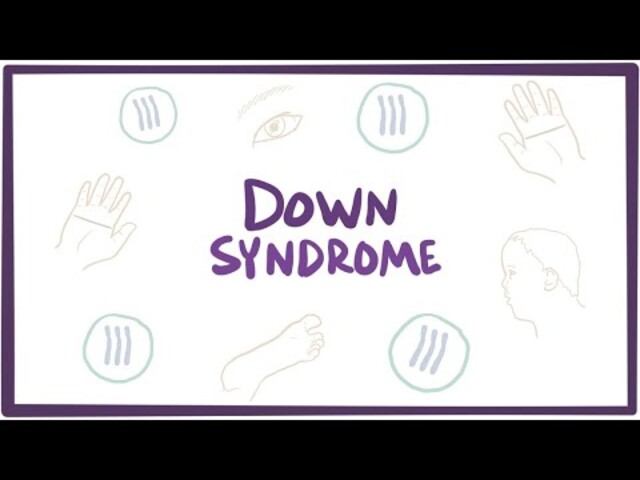 What causes Down syndrome?  NICHD - Eunice Kennedy Shriver