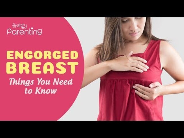 Engorged breasts: Symptoms, causes, and treatment