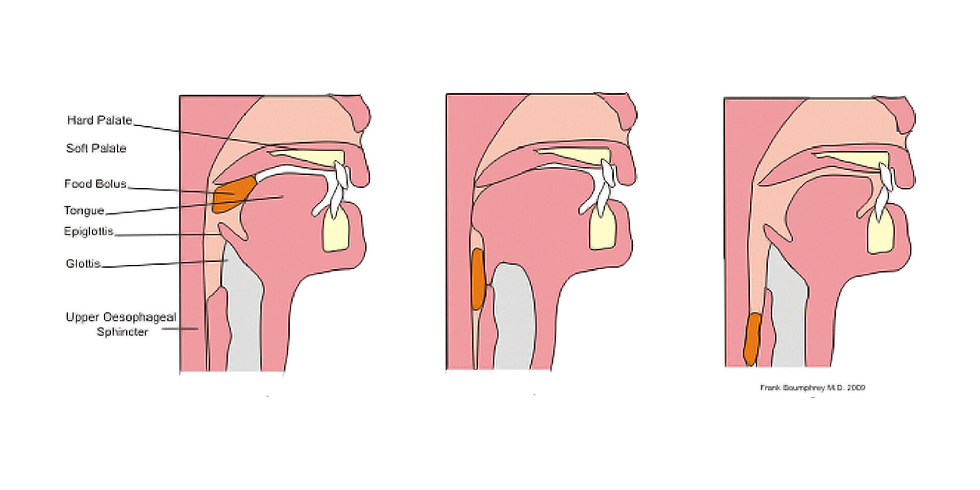 The Esophageal Phase of Deglutition - StoryMD