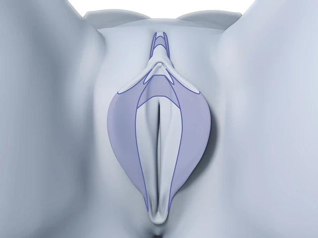 Labiaplasty Gone Wrong Saratoga Springs Plastic Surgeon Shares 6