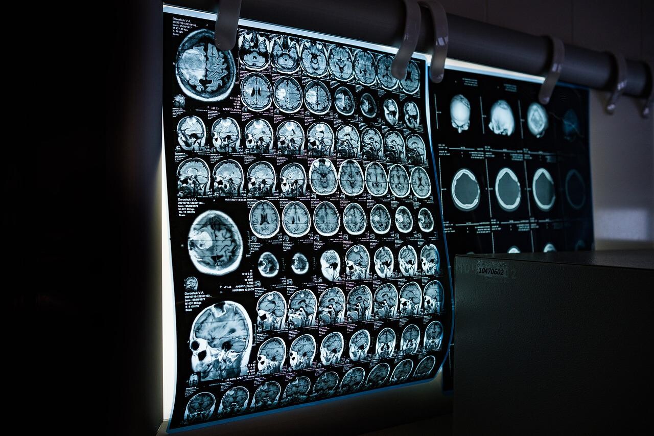 Radiation in Healthcare: Bone Density (DEXA Scan), Radiation, NCEH