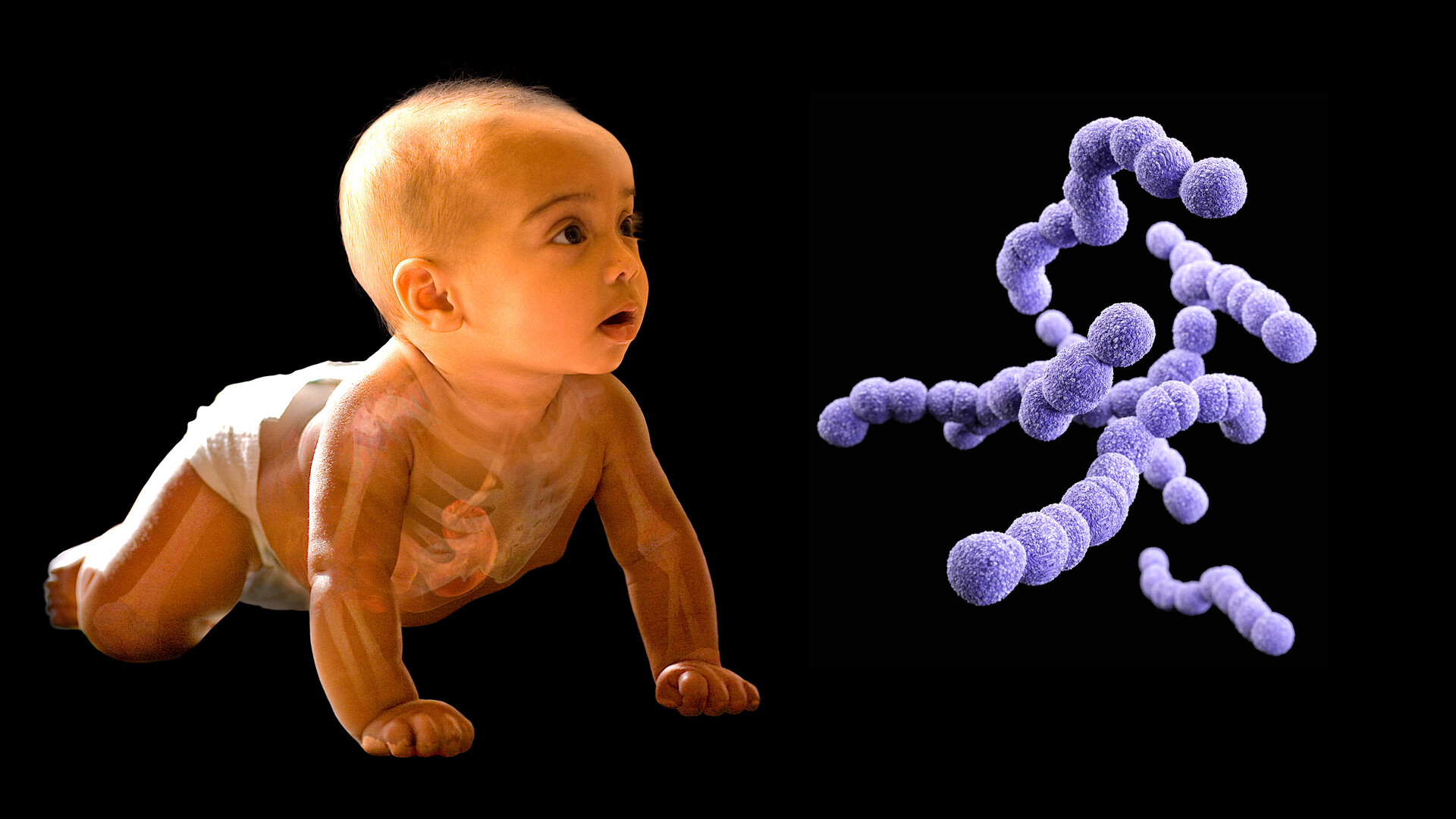 group-b-strep-types-of-infection-storymd