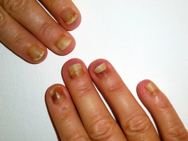What Are Your Nails Saying About Your Health? – Nouvelle Nail & Spa