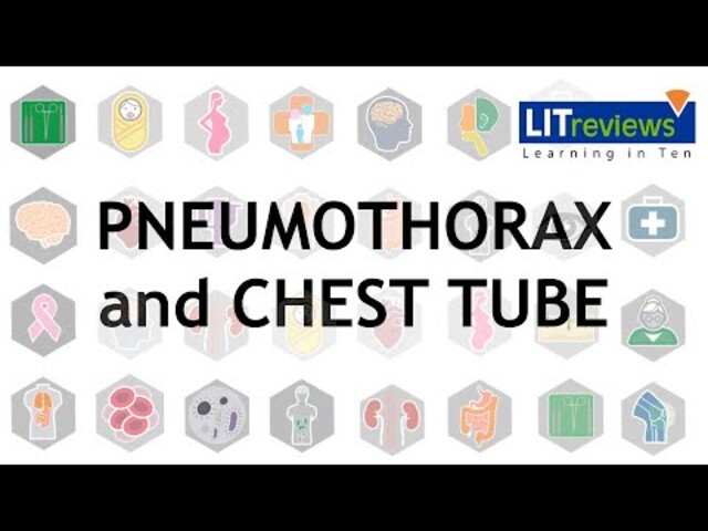 Thoracentesis - StoryMD