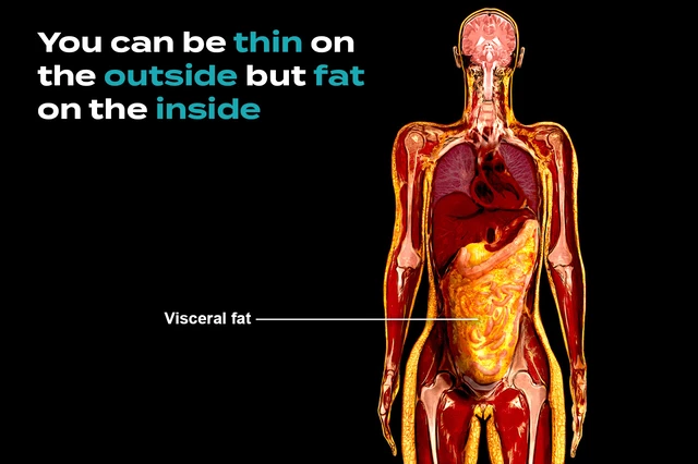 The link between abdominal fat and death: What is the shape of