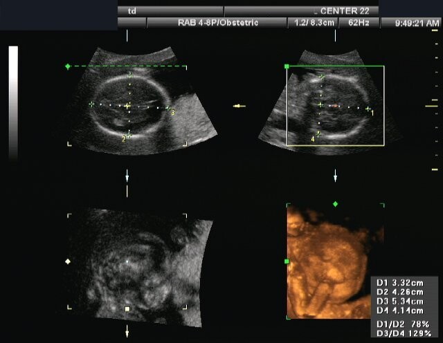 Un Ginecologo Esamina Una Donna Incinta. Auscultazione Cardiaca Fetale  Doppler Fotografia Stock - Immagine di doppler, anticipazione: 273151632