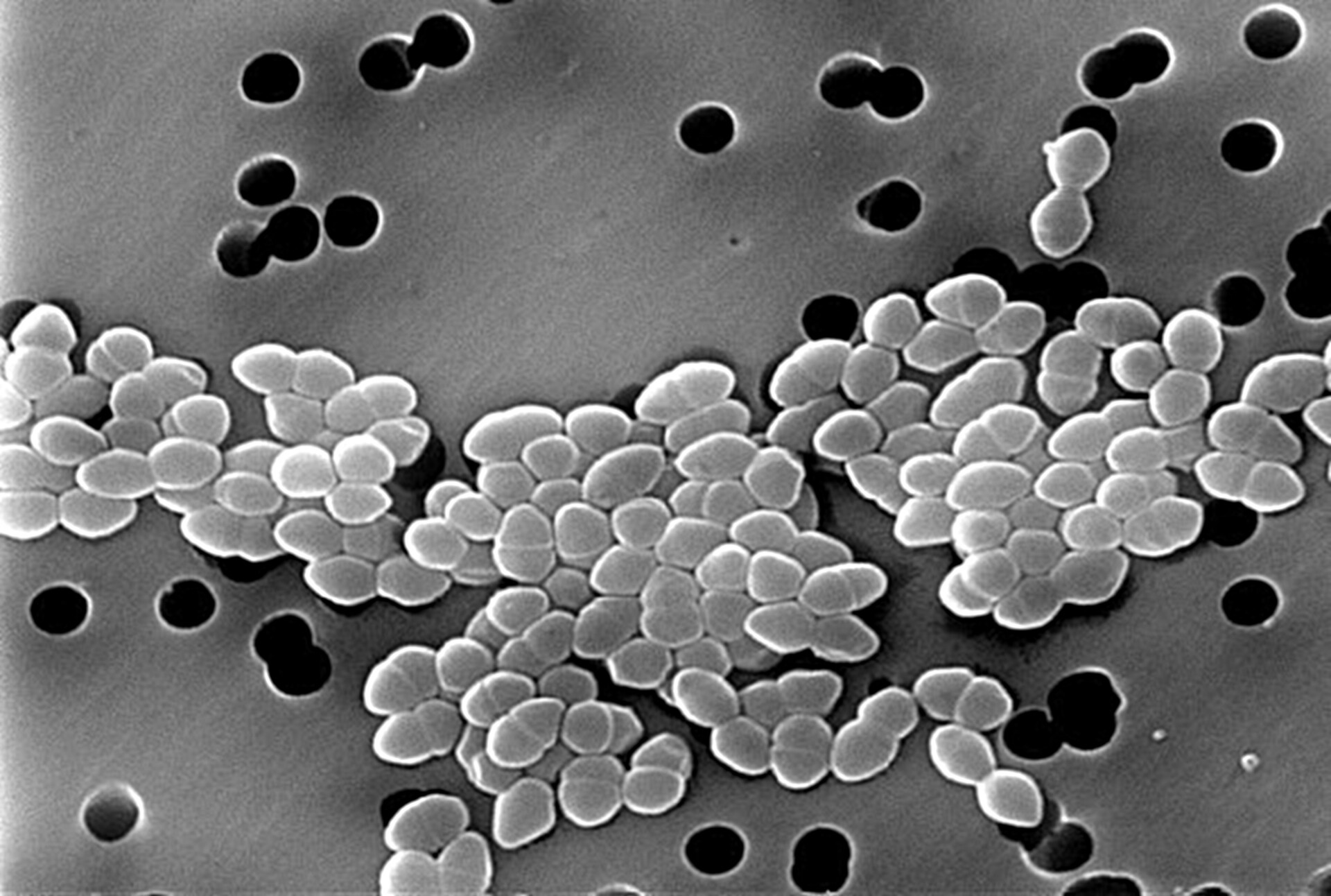 Staphylococcus aureus Bacteria, Scanning electron micrograp…