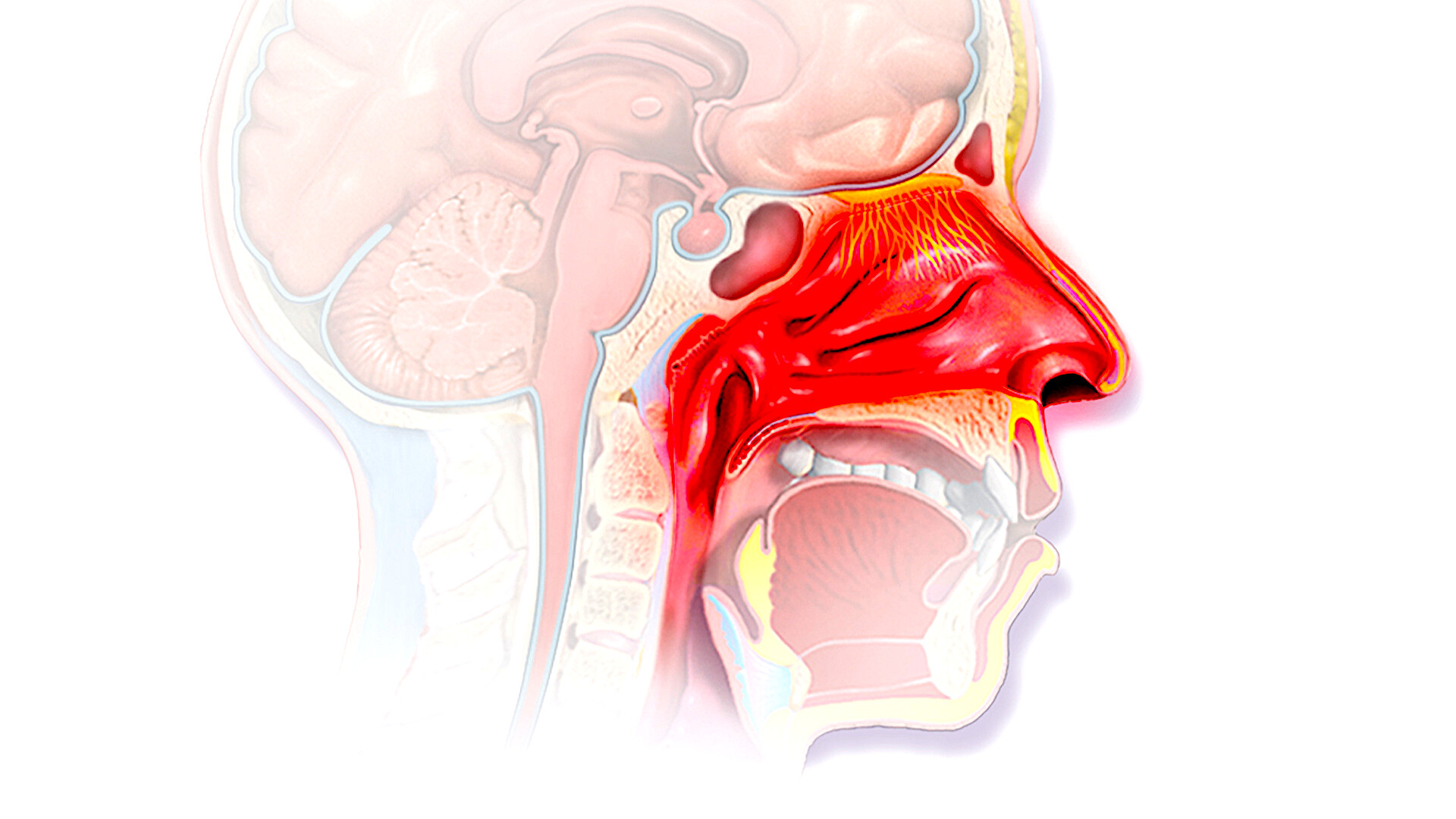 rhinitis-storymd