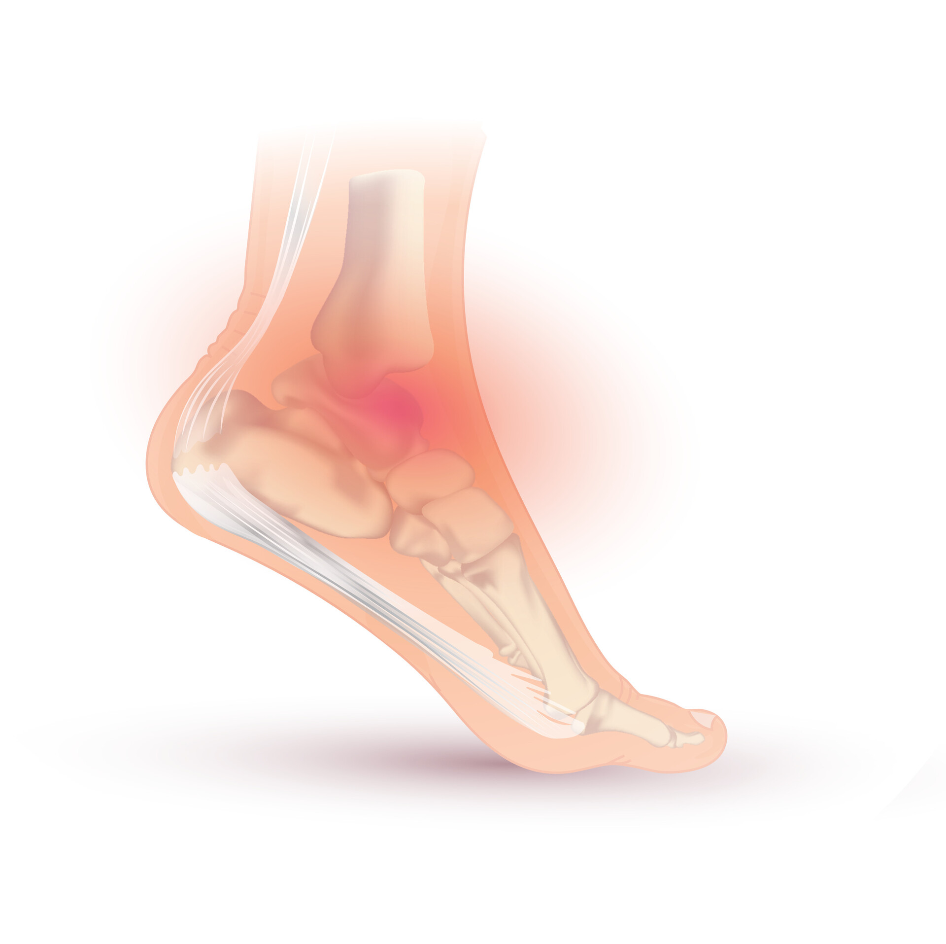 Ankle Injuries and Disorders - StoryMD