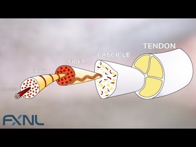 Patellar Tendonitis - StoryMD