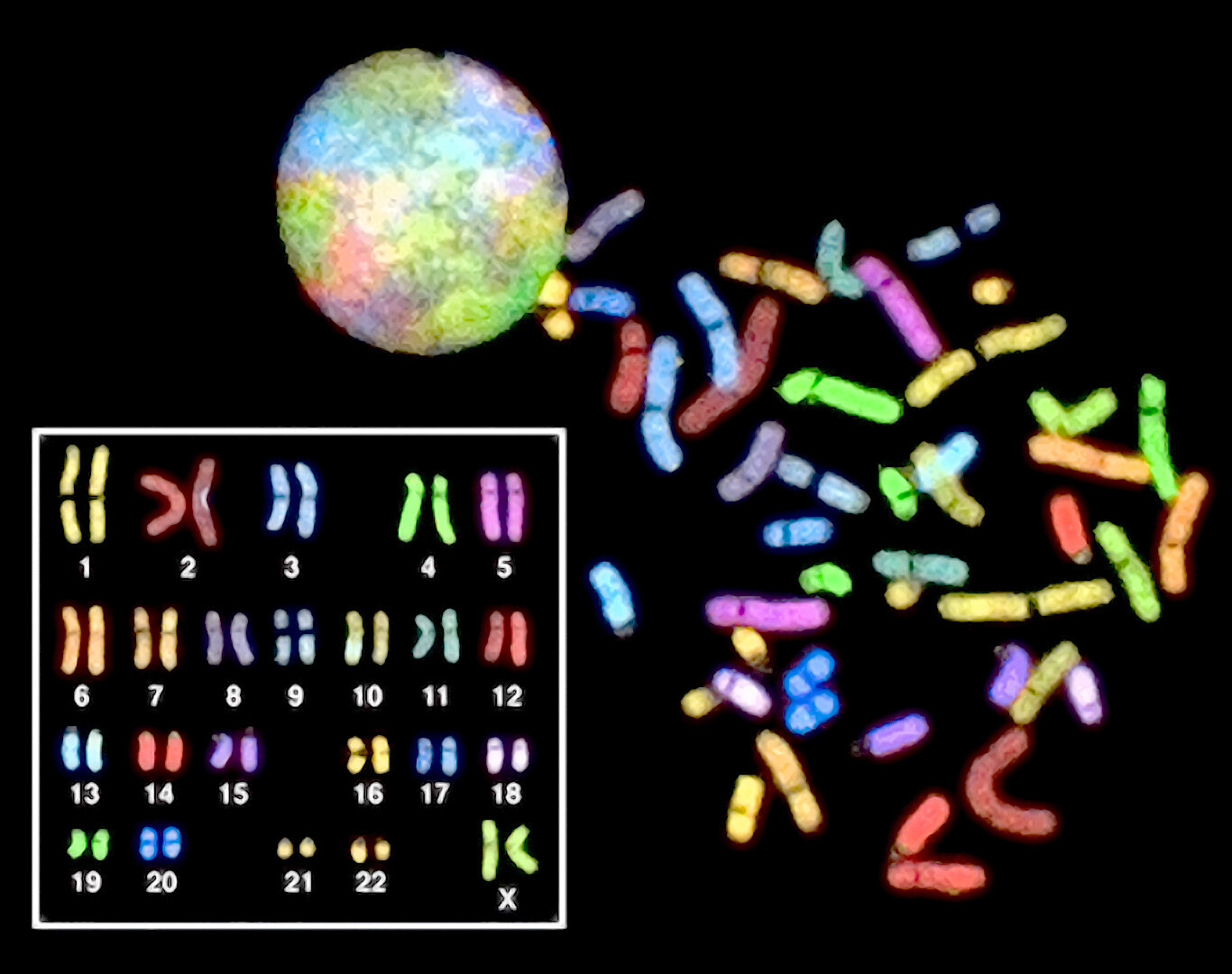 how-is-chromosome-15q-duplication-diagnosed-storymd