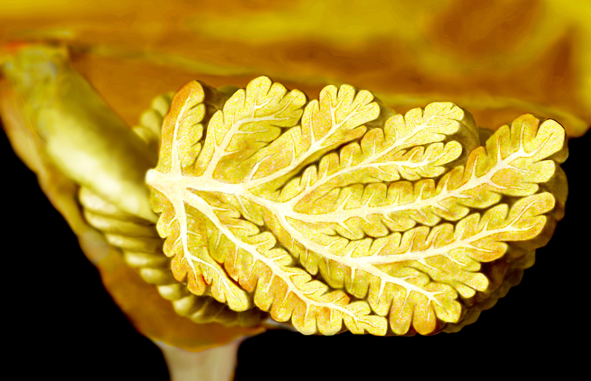 Pontocerebellar Hypoplasia Type 1 StoryMD