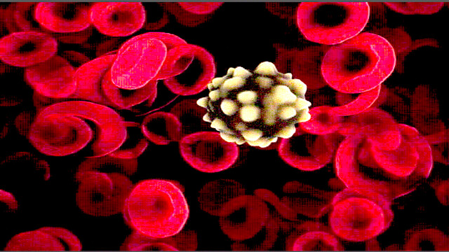 RDW (Red Cell Distribution Width) Test: Why Is It Done and What the Results  Mean - StoryMD