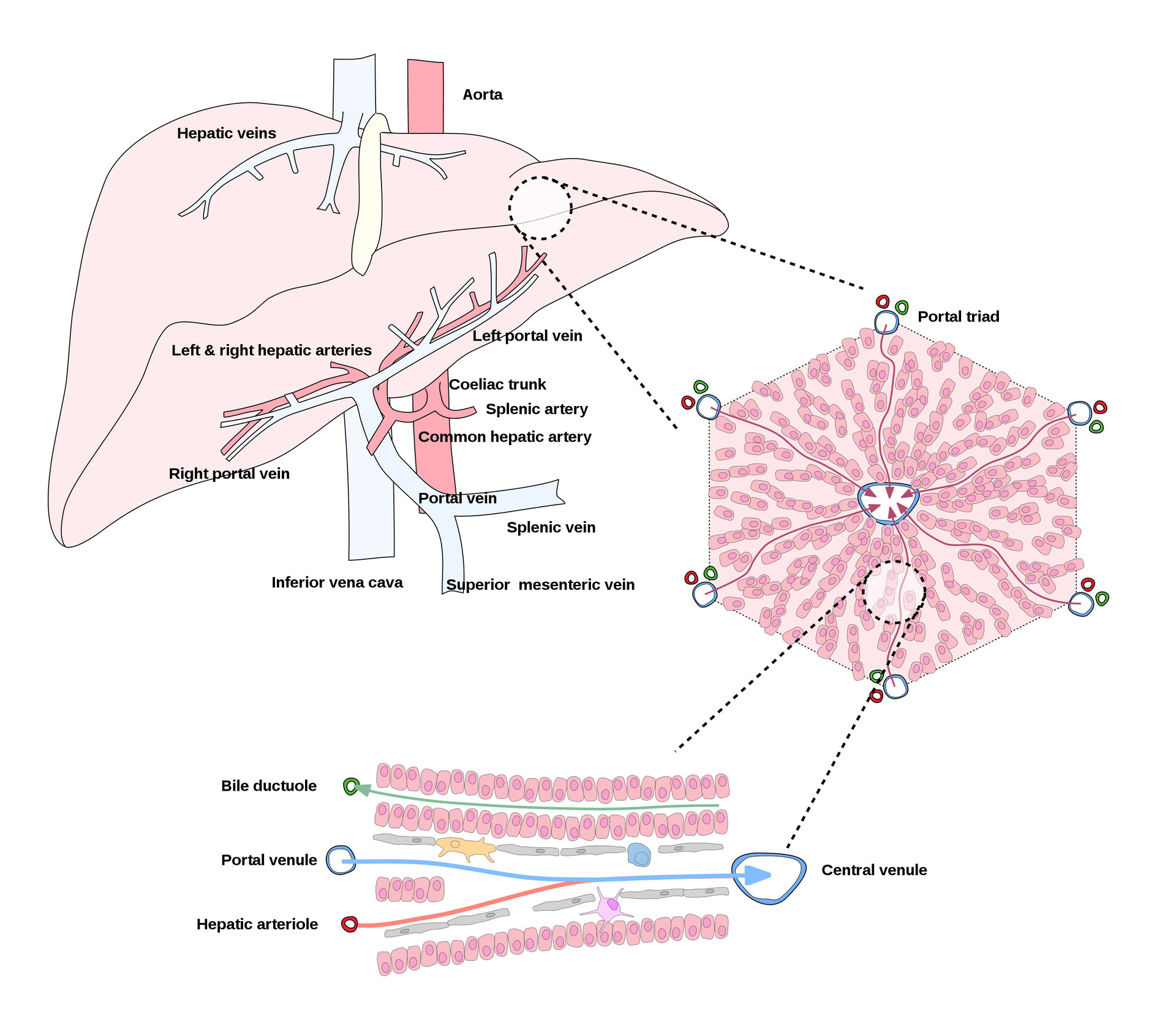 Benign Vascular Tumors of the Liver - StoryMD