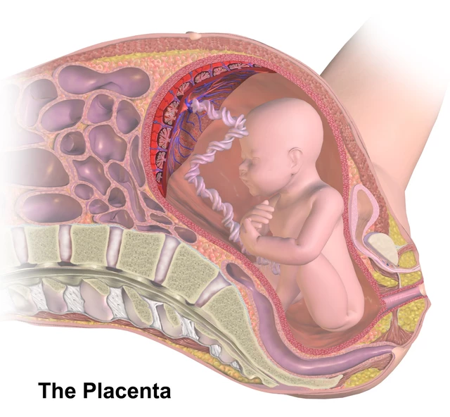 Succenturiate Lobe of the Placenta - StoryMD