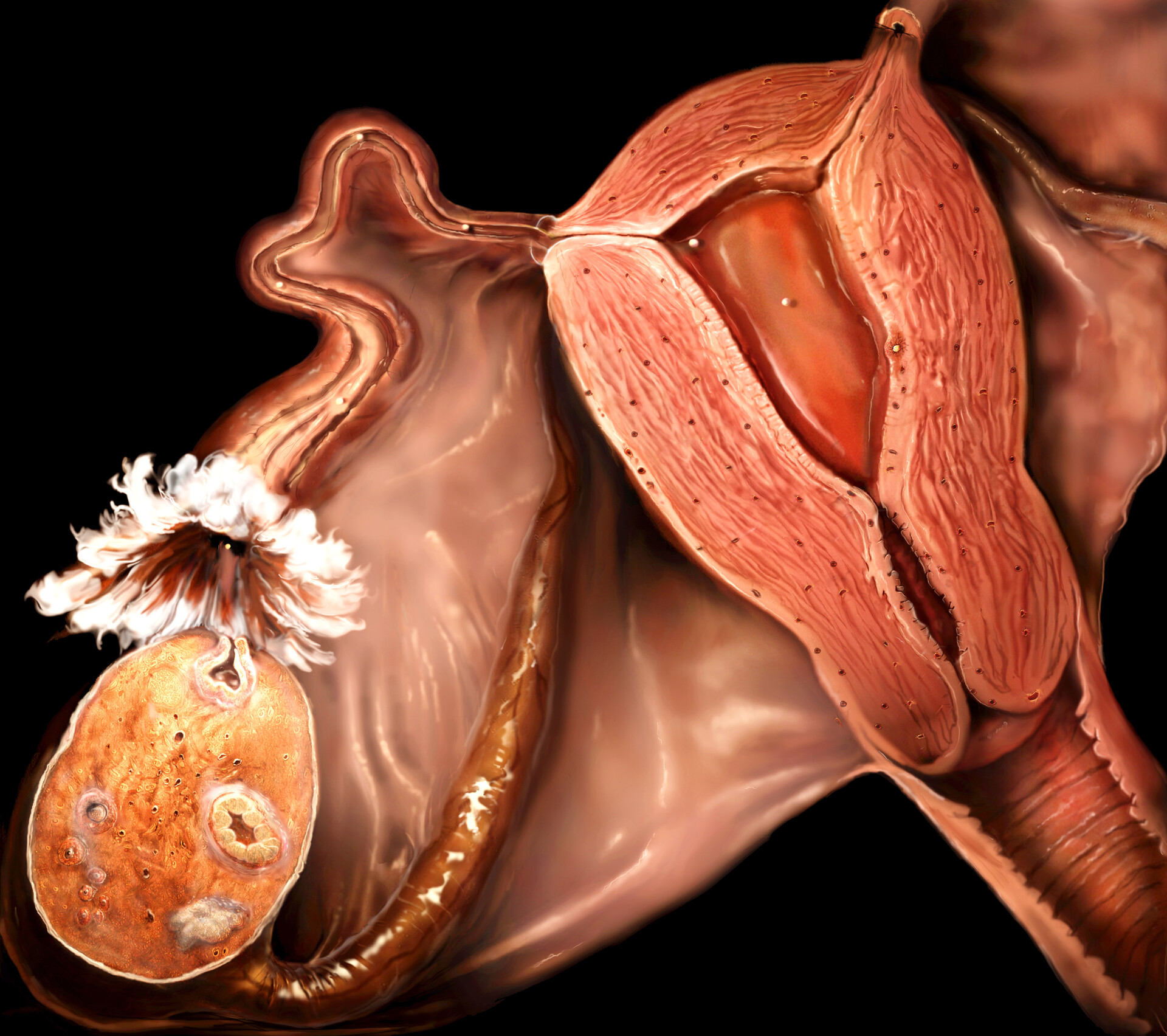 Inferior Ovary Is Found In Examples