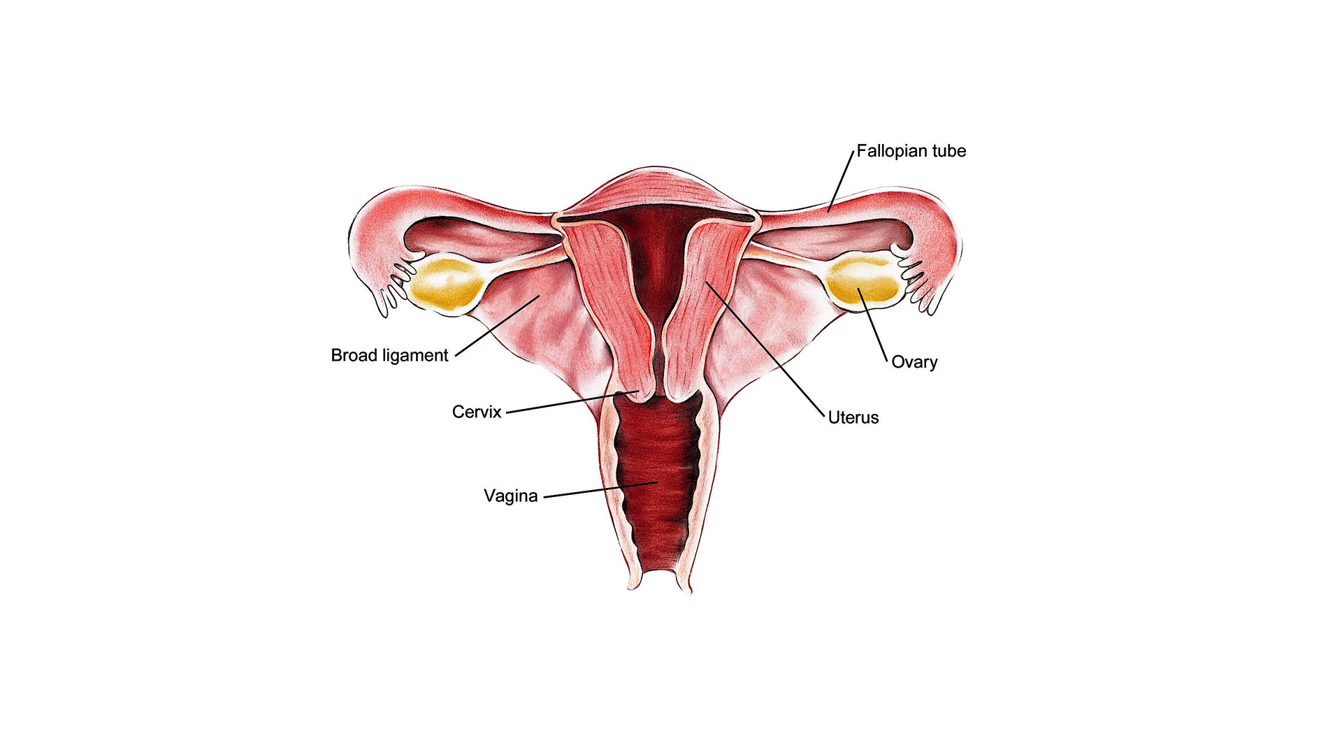 Ovarian Fallopian Tube And Primary Peritoneal Cancer Prevention Storymd