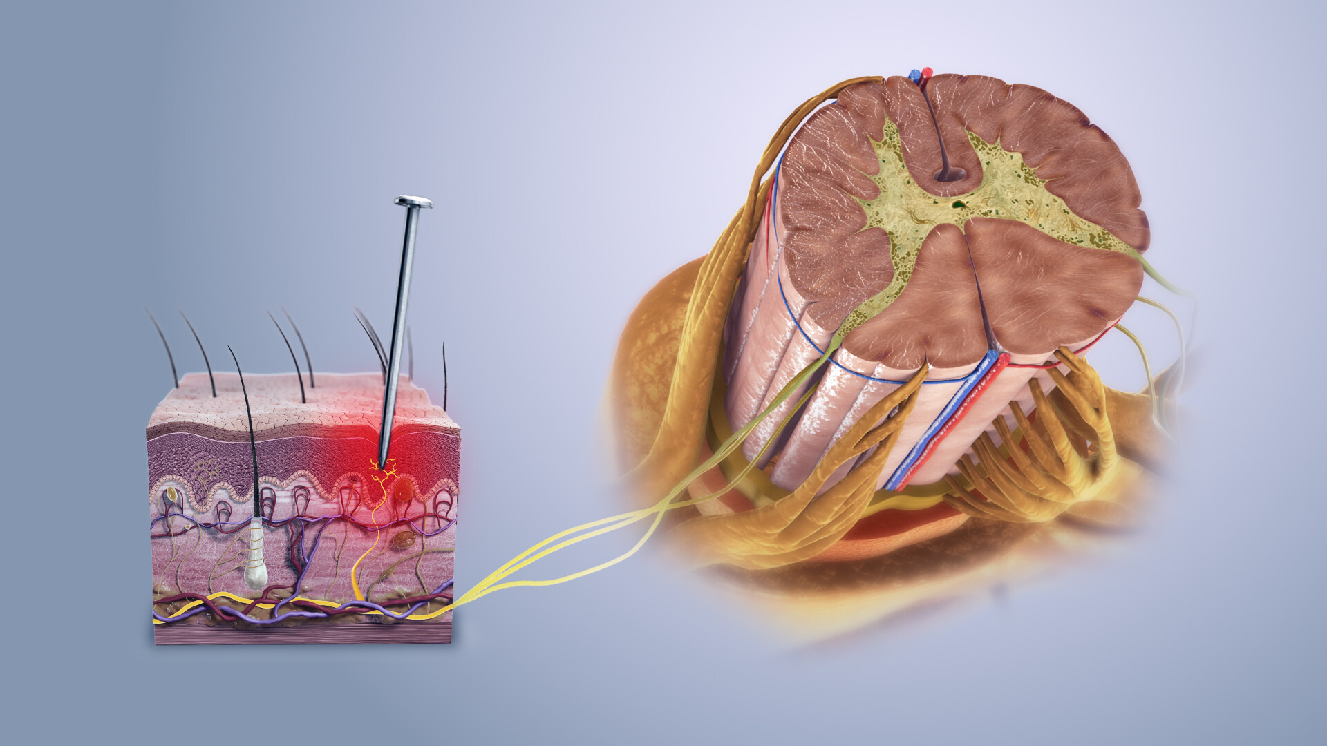 Sciatica - StoryMD