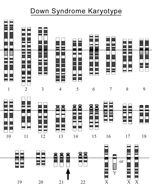 Is There a Cure for Down Syndrome? - StoryMD