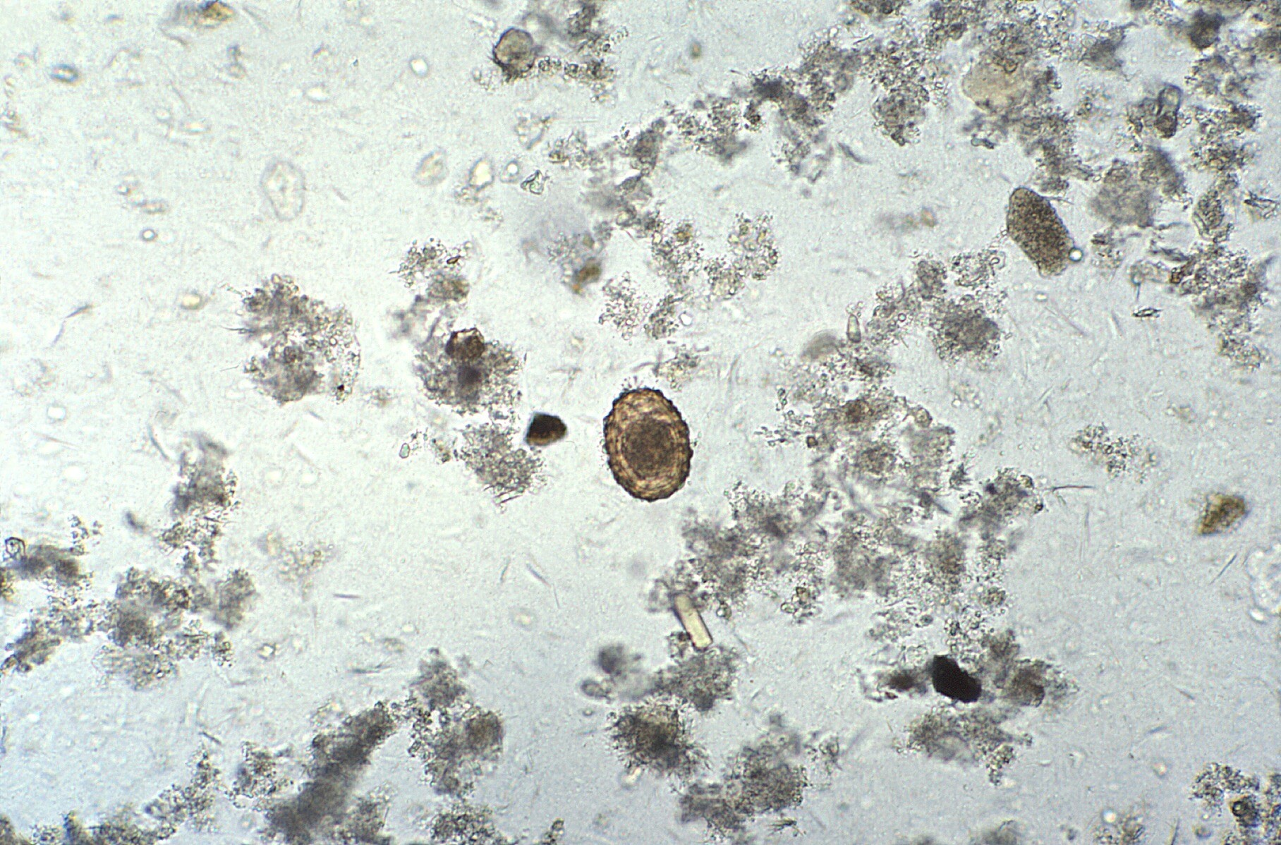 ascaris lumbricoides fertilized egg