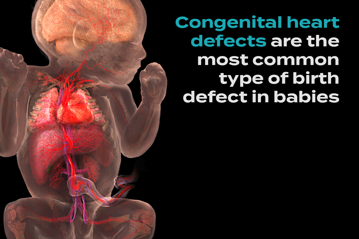 Congenital Heart Defect Buy Sale Www bharatagritech