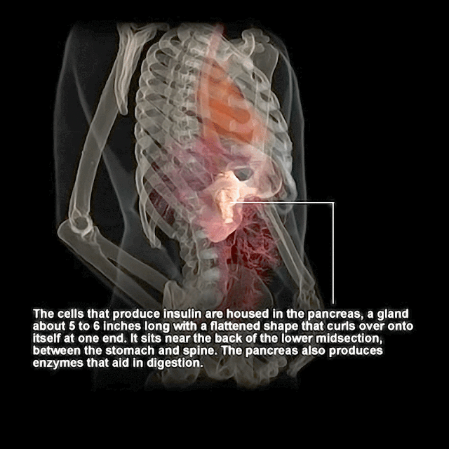 Exocrine and Endocrine Pancreas - StoryMD Exocrine and Endocrine Pancreas - StoryMD