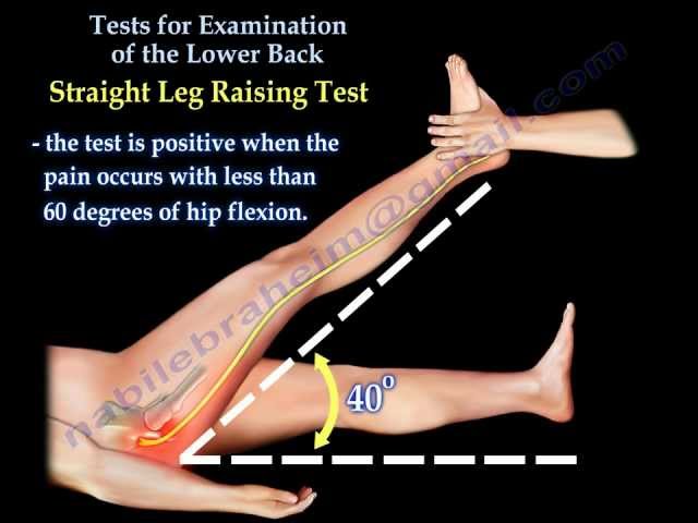 Acute Low Back Pain , Lumbar Disc Herniation - Everything You Need To Know  - Dr. Nabil Ebraheim 